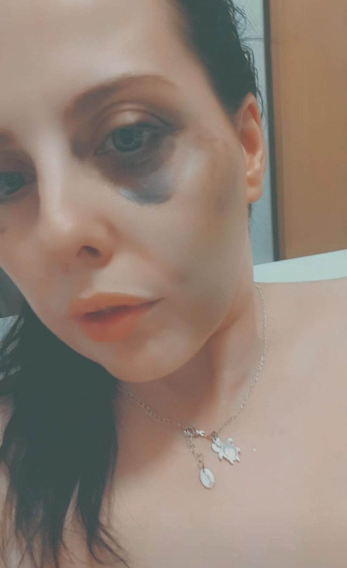 Katie after she was discharged from hospital