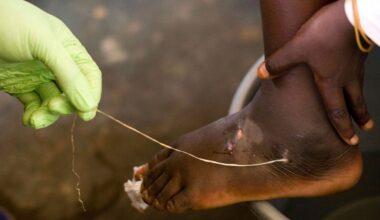 World Creeps Closer to Eradicating a Loathed Parasite