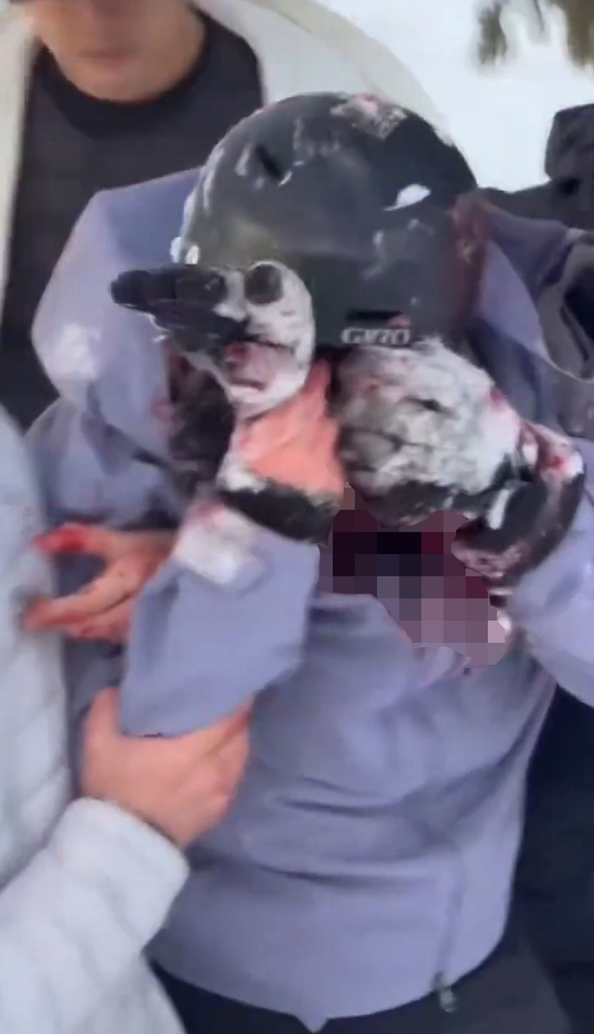 Woman being helped with blood on her face and jacket