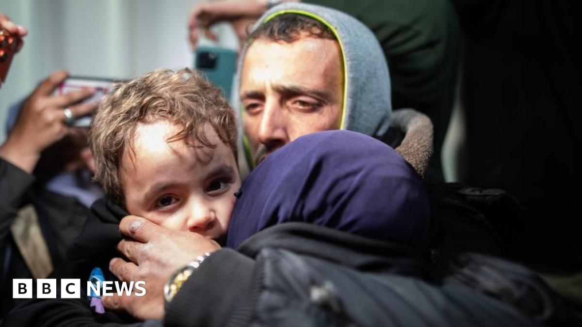 A young Palestinian boy being hugged by adults looks towards the camera at Nasser hospital, in Khan Younis, Gaza, after passing through the Rafah crossing with Egypt (2 February 2026)