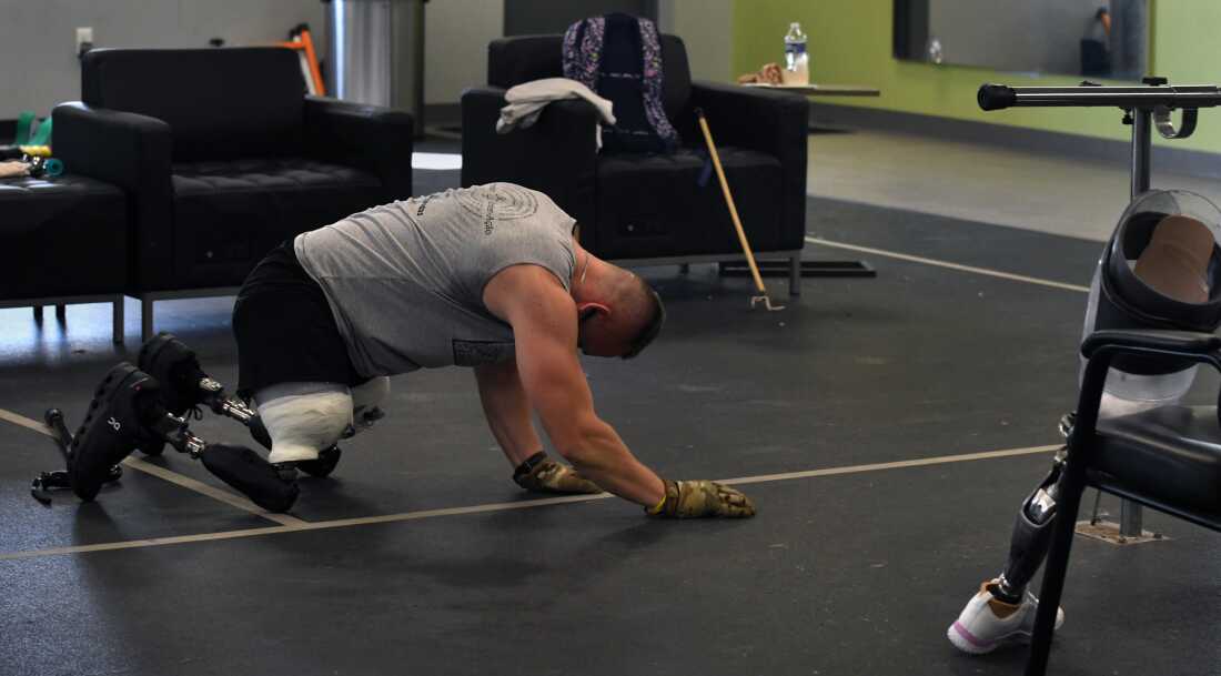 Sgt. Misha Varvarych, a Ukrainian war amputee struggles to keep balance while beginning to walk on his new prosthetic legs
