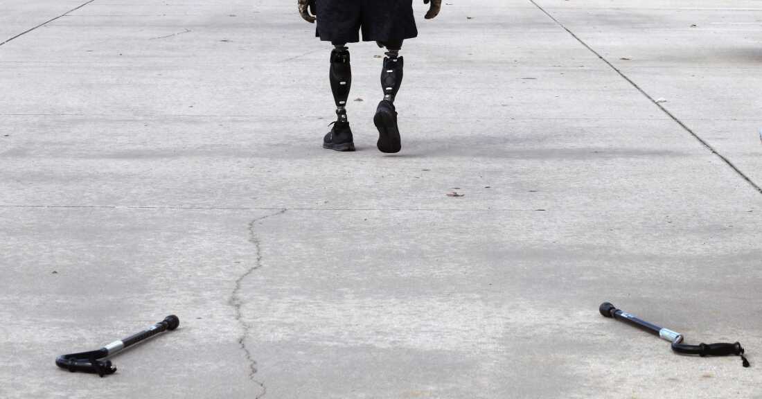 Sgt. Misha Varvarych, a Ukrainian war amputee, drops his canes in a dramatic gesture as he begins walking without assistance on his new prosthetic legs at the Prosthetic & Orthotic Associates center in Orlando, Florida, on March 10, 2023.