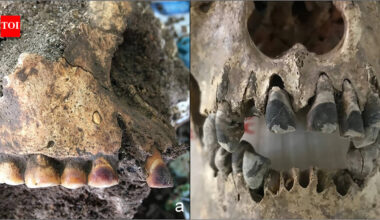 2,000 years ago, people in Vietnam used iron to permanently blacken their teeth | World News