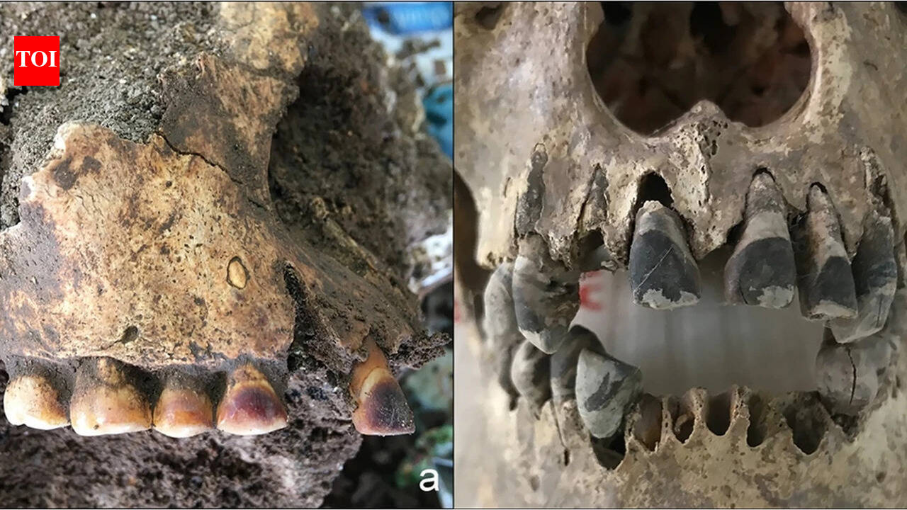 2,000 years ago, people in Vietnam used iron to permanently blacken their teeth | World News