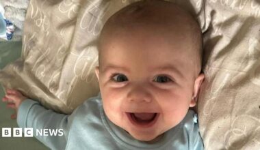 Jensen-Lee is lying on a pillow and smiling at the camera. He is wearing a blue babygro and his mouth is wide open.