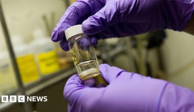 Close up of a woman in soft lighting, probably a wintry day, holds a tissue to her nose. She has freckles and a wedding ring is visible.