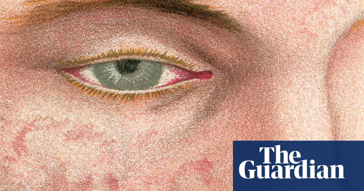 ‘We almost lost you in the night’ - the life-threatening rise of measles in the UK | Health