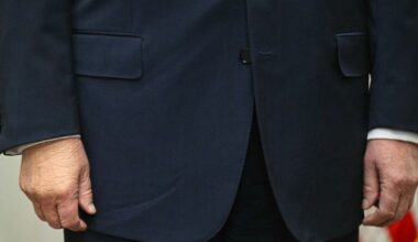 Trump's bruised hand now 'swollen' as health fears soar | World | News