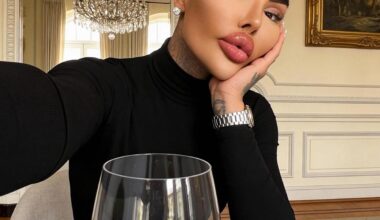 Two arrested after ‘Lip King’ dies 'following cosmetic surgery' - London Evening Standard