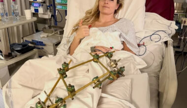 Lindsey Vonn shares photo from hospital bed after third surgery following 2026 Olympics crash