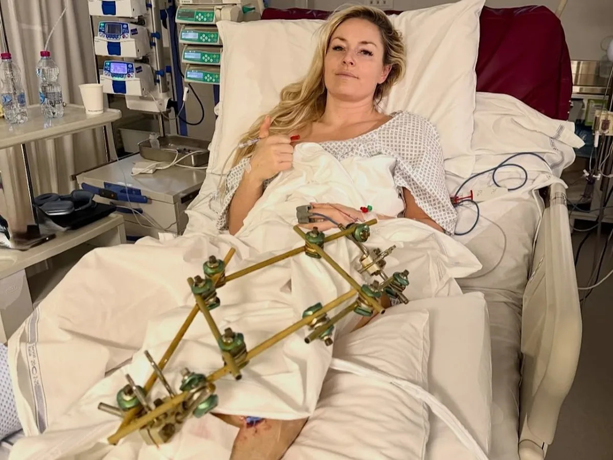 Lindsey Vonn shares photo from hospital bed after third surgery following 2026 Olympics crash