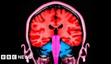 Brain stimulating test makes people 'less selfish' - BBC