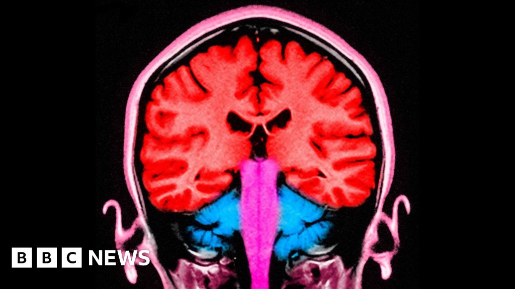 Brain stimulating test makes people 'less selfish' - BBC