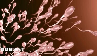 Stock image of translucent white sperm swimming against a darkish red background