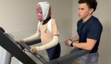 1 year after deadly Northeast Philadelphia plane crash, inside 10-year-old Ramesses' road to recovery