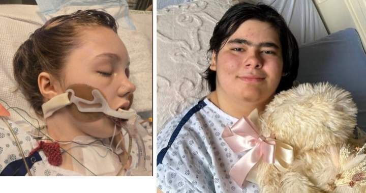 Tumbler Ridge school shooting victim set to hopefully return home soon from Vancouver hospital