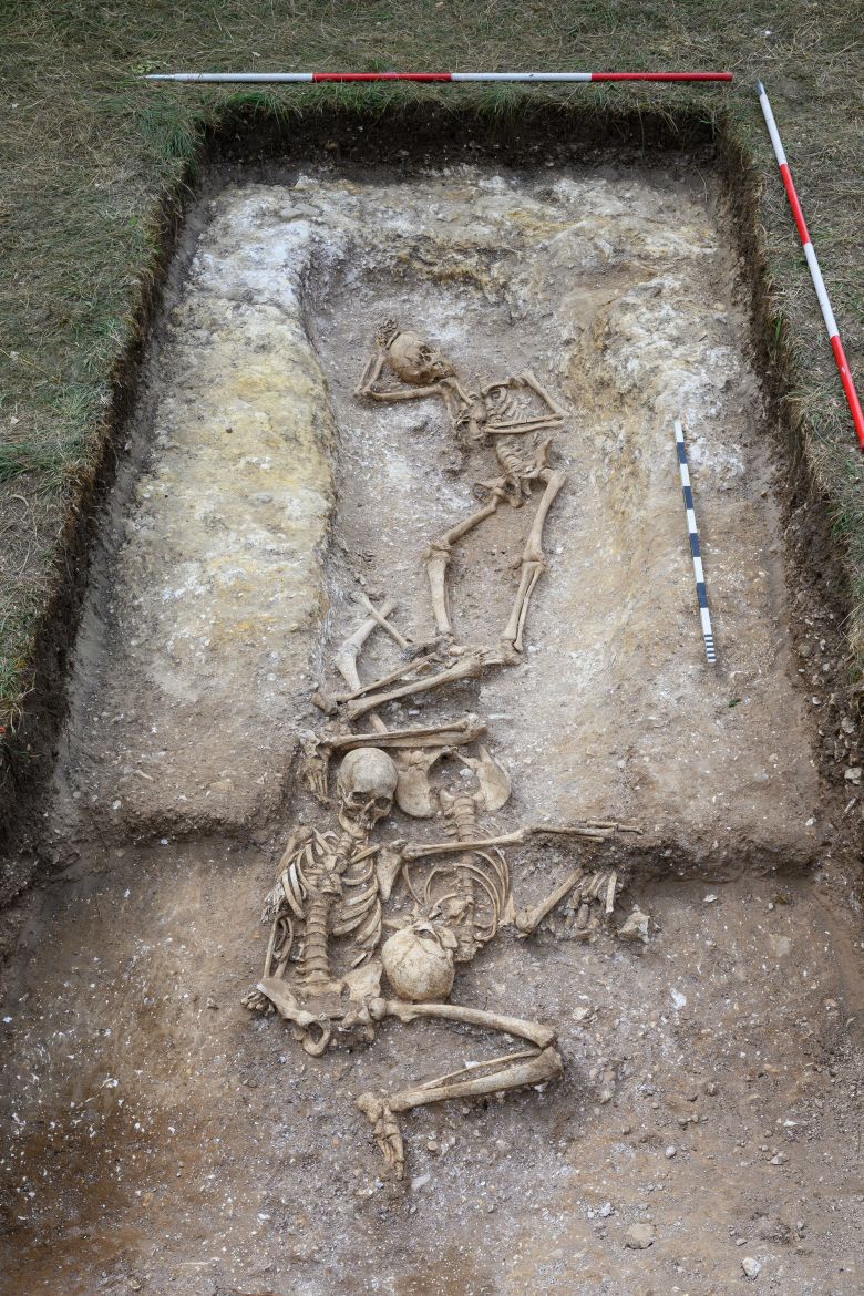 One of the bodies had a trepanned skull.