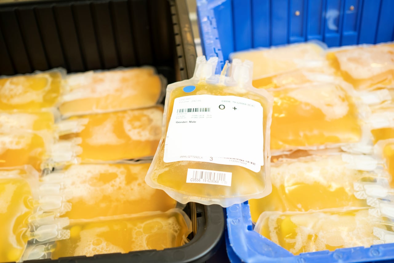 A close-up of clear medical bags filled with a yellow liquid.