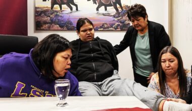 Pimicikamak teen says hospital hotel kicked him out while recovering from surgery