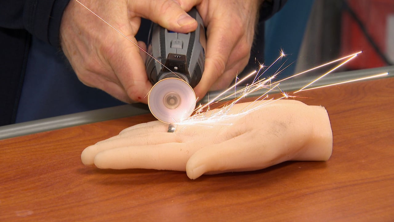 Sparks fly from a ring on a rubber hand that Dr. Spencer is trying to cut through with a industrial cutter tool. 