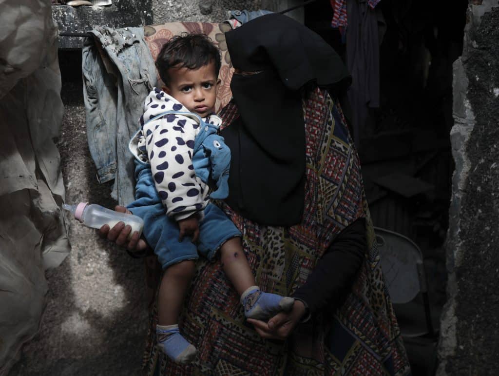 18-month-old Jawad Abu Nassar was returned by the Israeli army top his family with burn marks and puncture wounds, in what the family says was the result of torture, according to doctors, March 24, 2026. (Photo: Ramzi Abu Amer/APA Images)