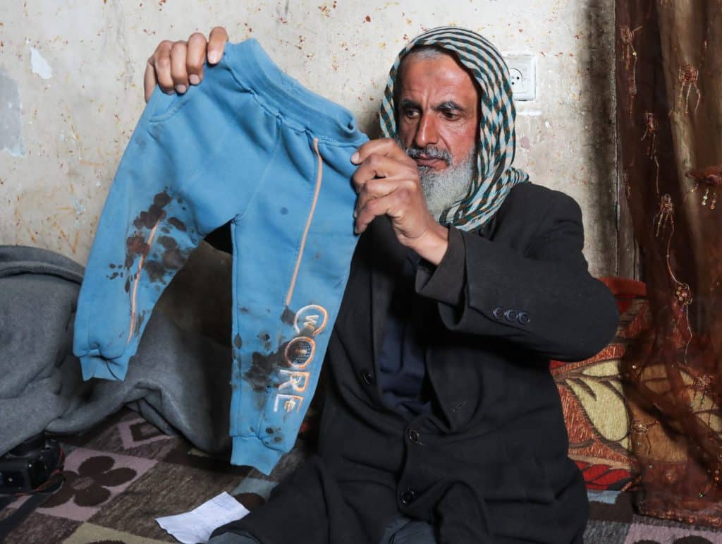 18-month-old Jawad Abu Nassar was returned by the Israeli army top his family with burn marks and puncture wounds, in what the family says was the result of torture, according to doctors, March 24, 2026. (Photo: Ramzi Abu Amer/APA Images)