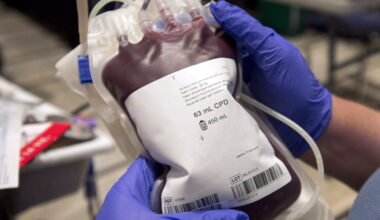 Two Winnipeggers dead after donating plasma