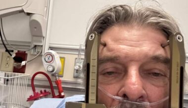 Edmonton clinical trial offers hope to people suffering ‘most severe pains known to mankind’