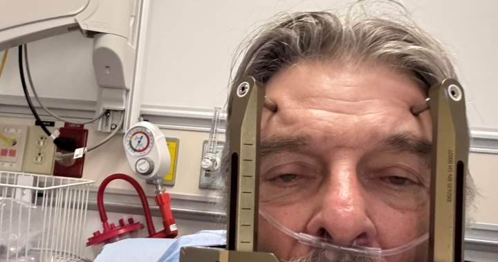 Edmonton clinical trial offers hope to people suffering ‘most severe pains known to mankind’