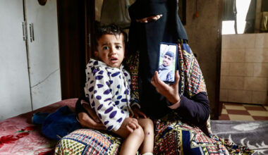 Gaza toddler released from Israeli custody with ‘cigarette burn’ wounds