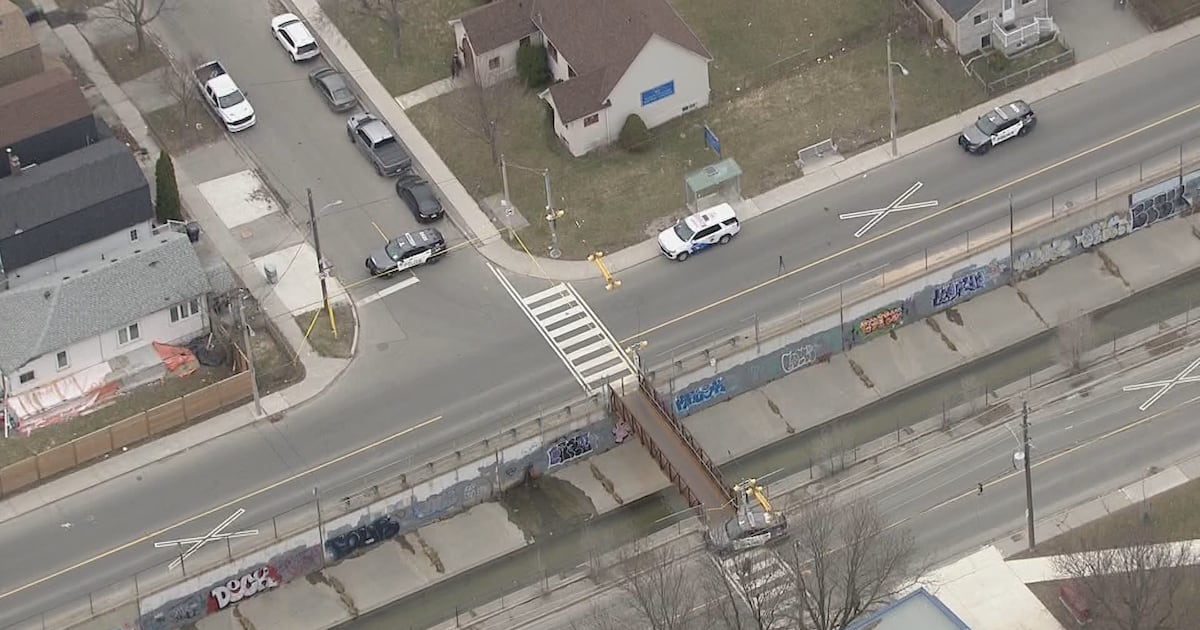 Toronto student struck by vehicle suffers life-threatening injuries