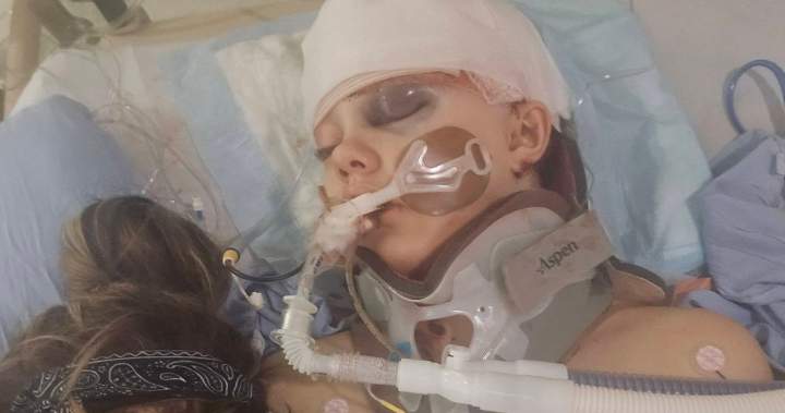 Family of Tumbler Ridge shooting survivor sues OpenAI