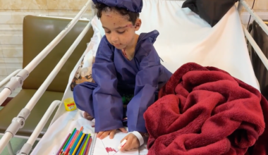 Children wounded in the US-Israeli strikes receive treatment in Tehran | US-Israel war on Iran