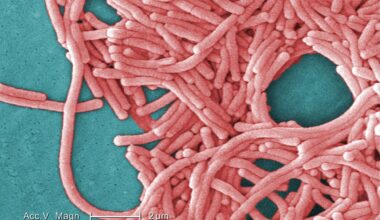 Everything we know about the Legionnaires' outbreak in London - London Evening Standard