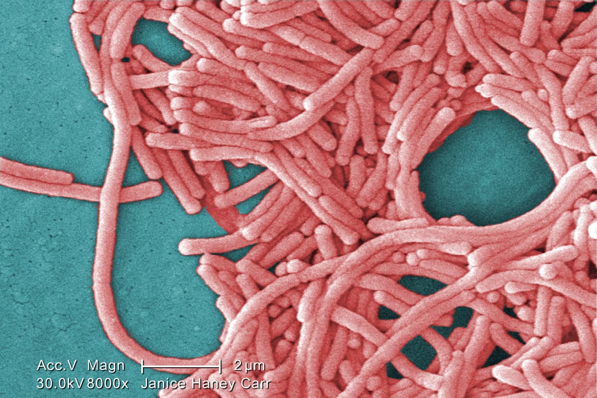 Everything we know about the Legionnaires' outbreak in London - London Evening Standard