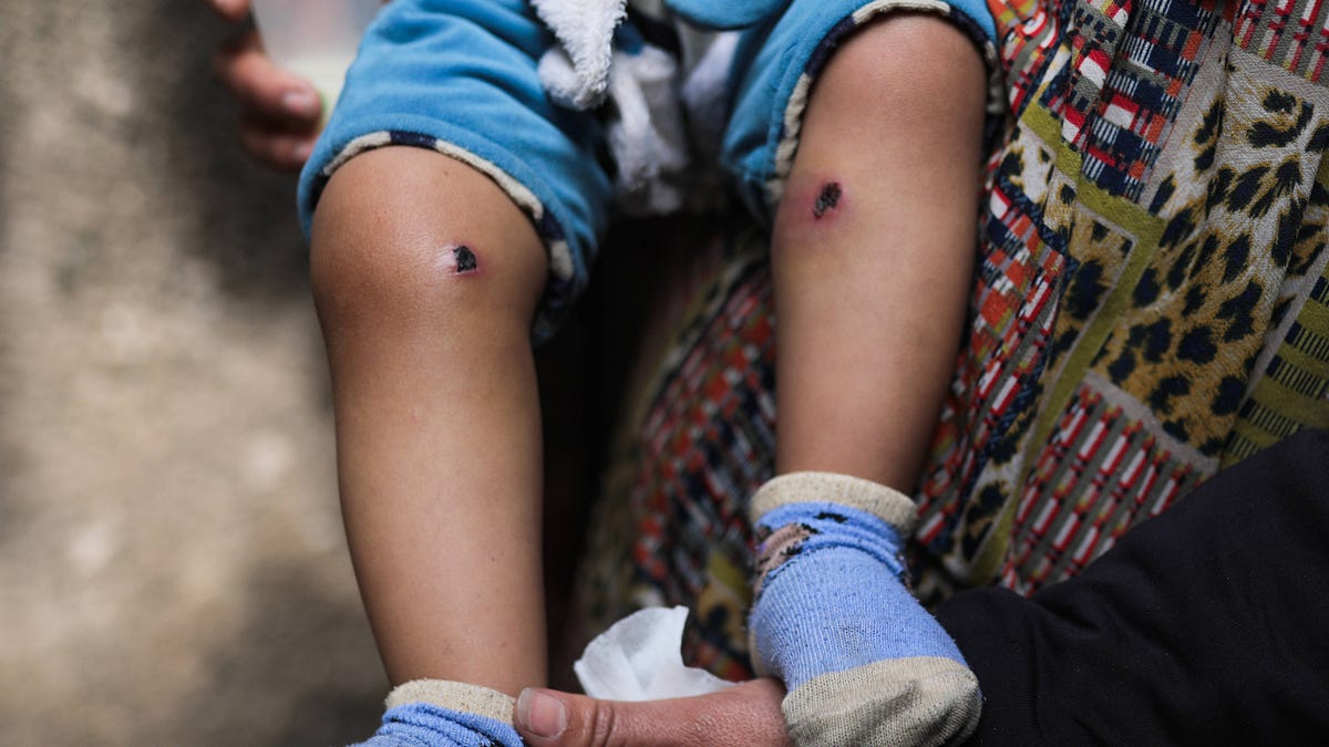 Israeli Forces Allegedly Torture Gaza Toddler to Force His Father to Confess