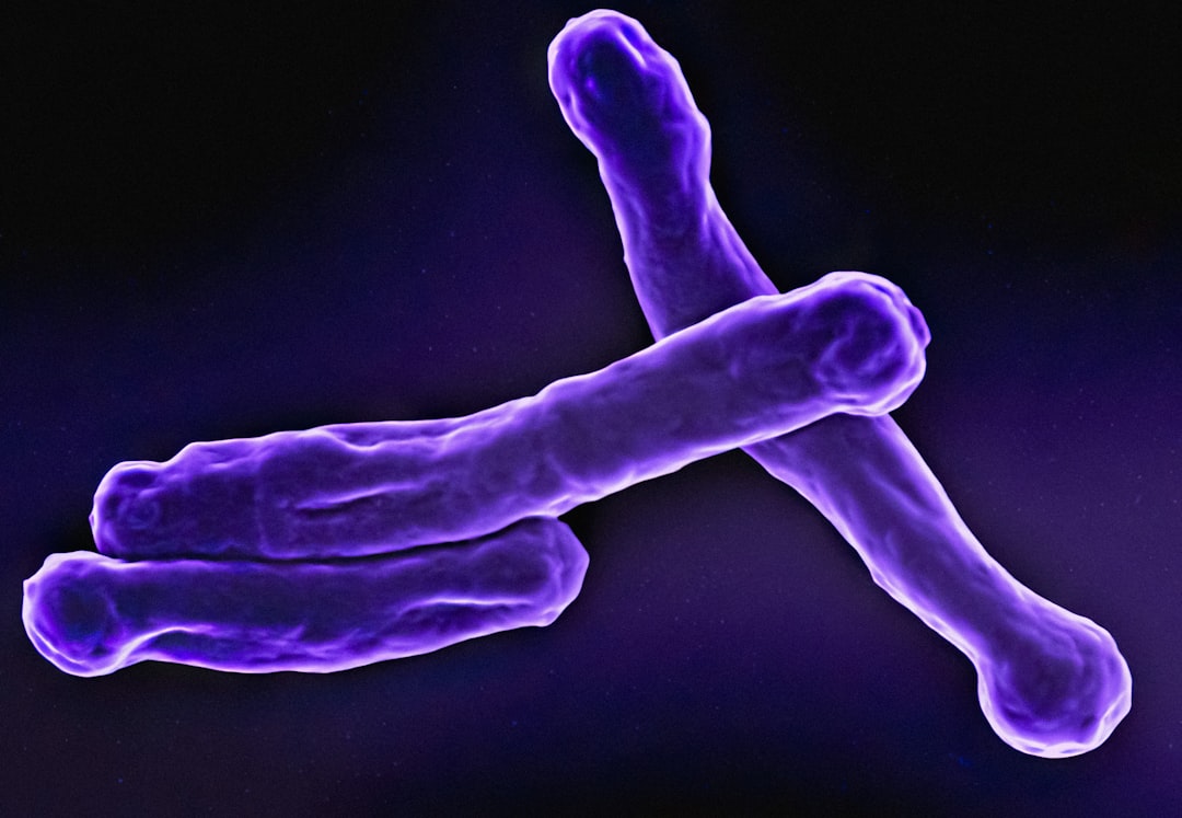 Israel reports pulmonary TB patient at Sheba Medical Center