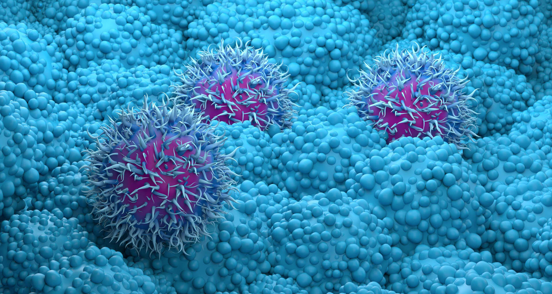 Pancreatic cancer drug daraxonrasib from Revolution Medicines succeeds in trial