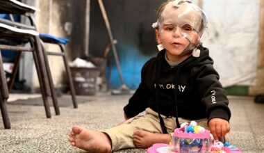 Born during Israel’s genocide: Gaza’s child survivors bear the scars of war | Israel-Palestine conflict