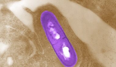 CFIA announces recalls for salads, cheeses and meal kits over listeria concerns