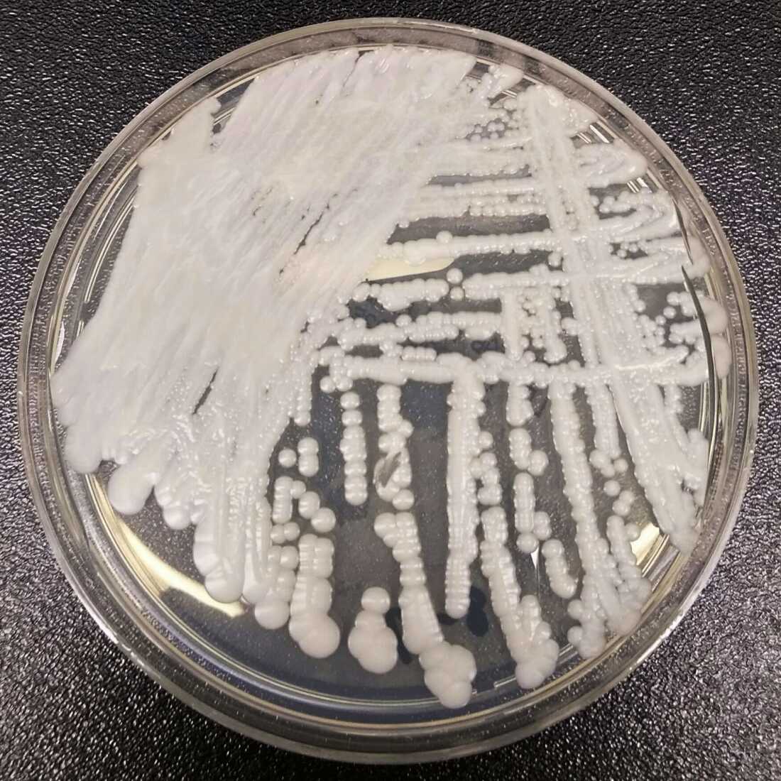 Astrain of Candida auris cultured in a petri dish at a CDC laboratory