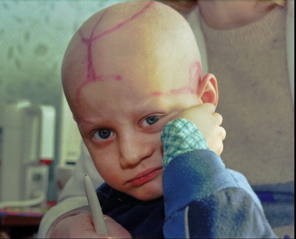 Alec Zhloba sits in a children's cancer ward with markings made by doctors on his head following chemotherapy in Gomel, Belarus, March 19, 1996, nearly 10 years after the explosion and fire at the Chernobyl nuclear power plant sent radioactive clouds through Ukraine, Belarus and other parts of Europe. (AP Photo/Efrem Lukatsky, File)