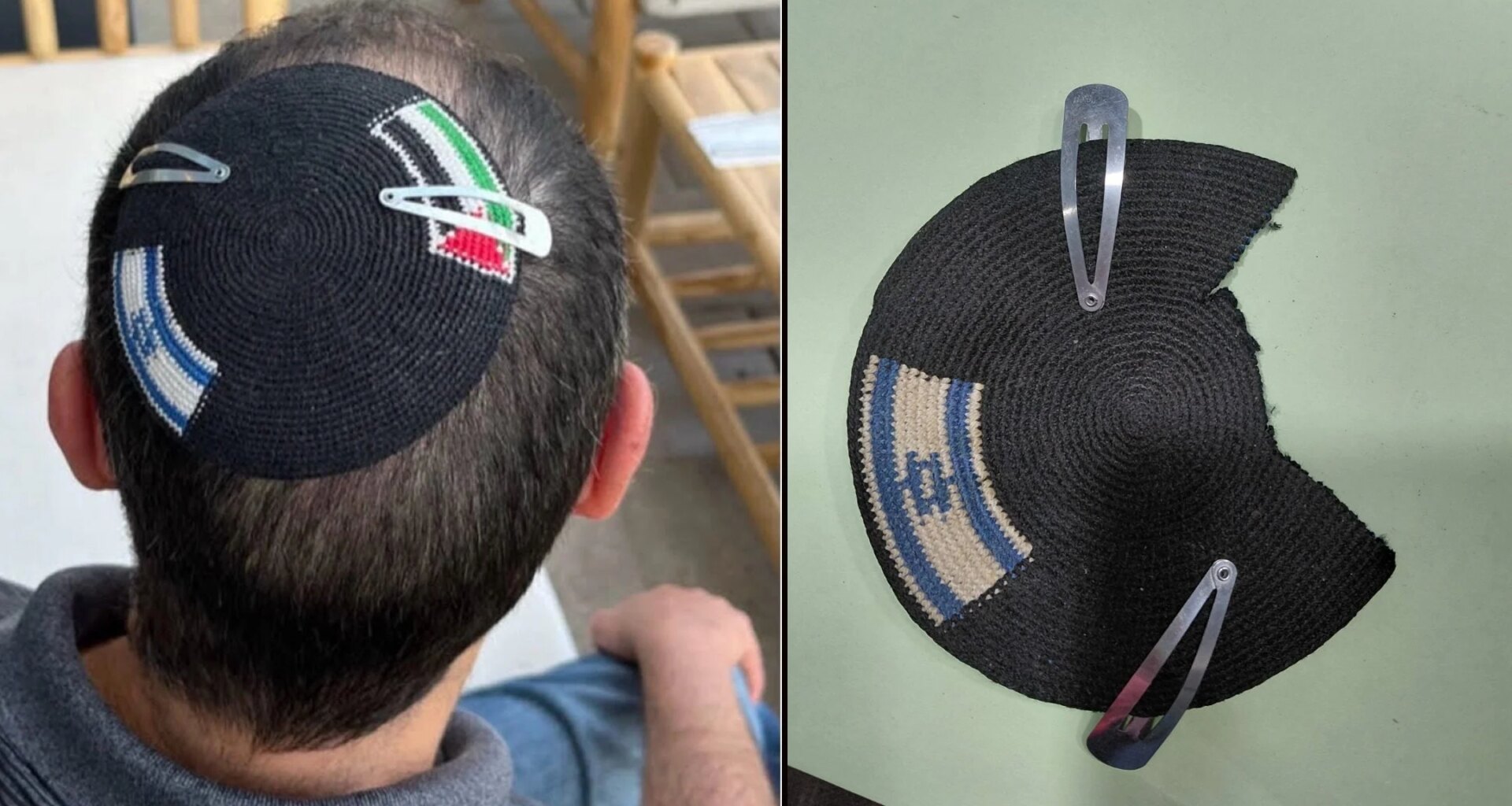 Man whose coexistence kippa was carved up by Israel Police asks 'what is in store for us'