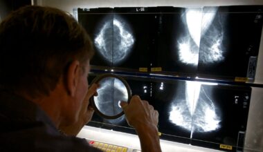 Cancer incidence and mortality rates decline across Canada, but some cancer types are increasing - CTV News