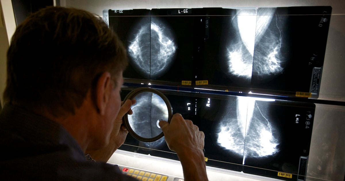 Cancer incidence and mortality rates decline across Canada, but some cancer types are increasing - CTV News