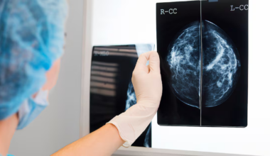 Province expanding free breast cancer screening to Albertans 40 and over - CTV News