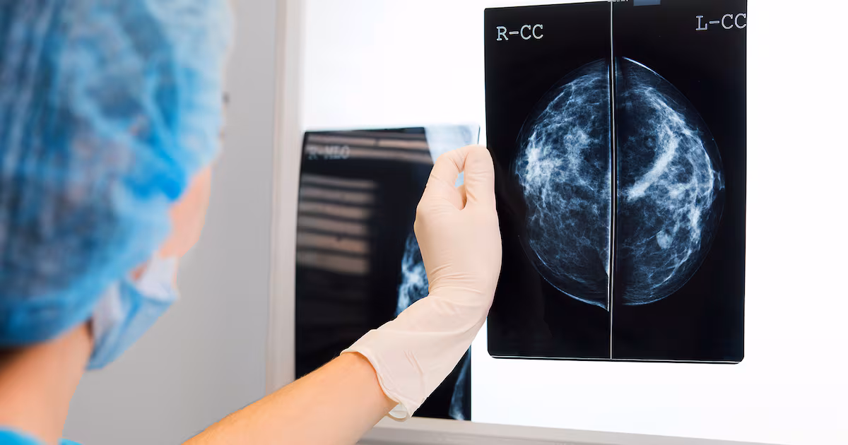 Province expanding free breast cancer screening to Albertans 40 and over - CTV News