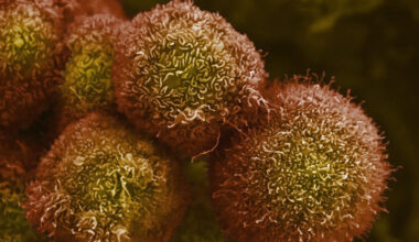 Revolution Medicines touts success in pancreatic cancer treatment