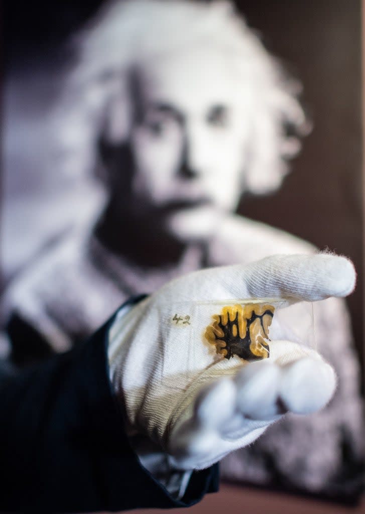 Gloved hand holding a small, preserved piece of brain tissue with Albert Einstein's blurred photograph in the background