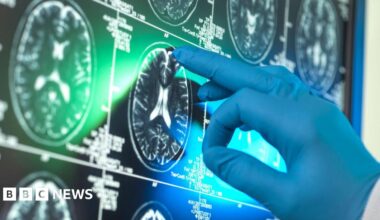 A blue gloved hand points a middle finger at a screen showing a collection of black and white scans of cross-sections of the brain. They look like white ovals where the outline of the skull is visible.